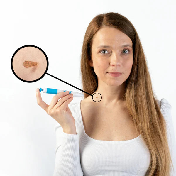 TagBand® | Tecnologia Dermatológica em Casa